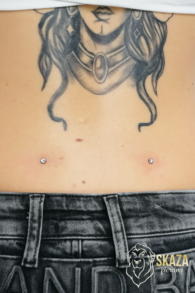 Dermal2
