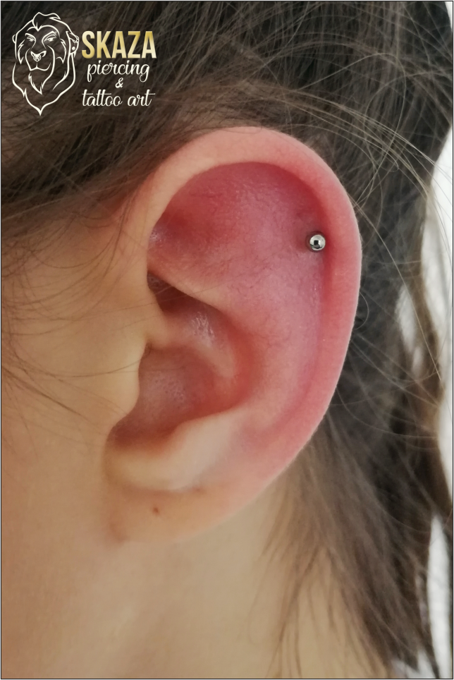 helix1