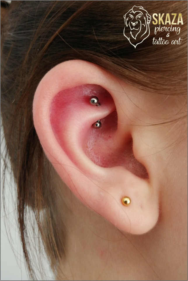 rook2