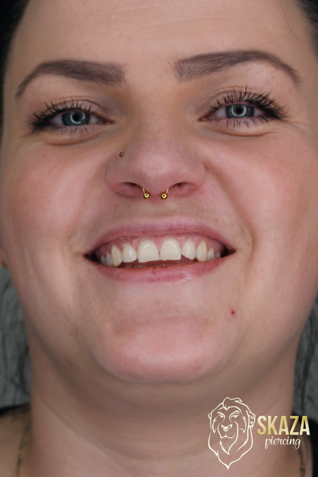 septum4