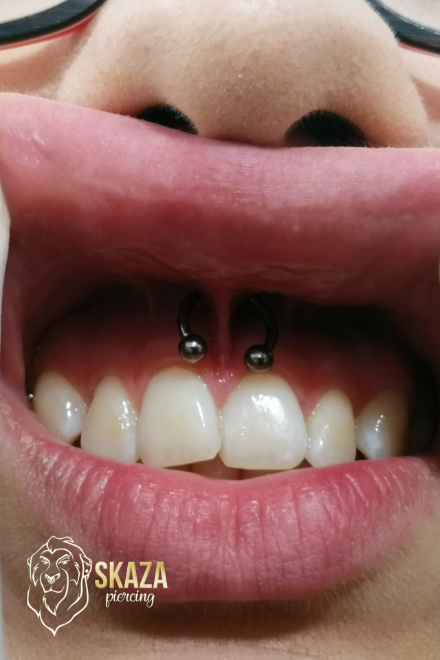 smile2